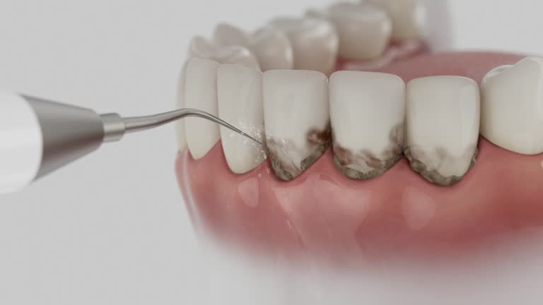 Trusted Dental Crowns And Bridges service in Alondra Park, CA - Dentist Open Now